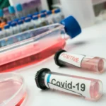 COVID-19 with constipation