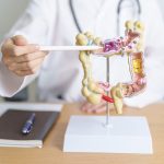 Diverticular Disease Protocol with Constipation