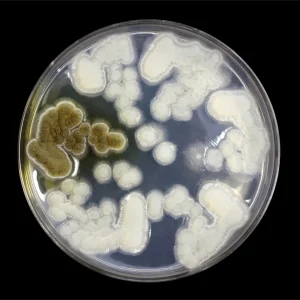 Yeast/Candida Protocol with neither Diarrhea nor Constipation