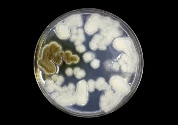 Yeast/Candida Protocol with neither Diarrhea nor Constipation